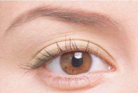 深圳埋線雙眼皮多少錢(qián)