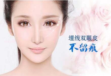 北京埋線雙眼皮貴嗎