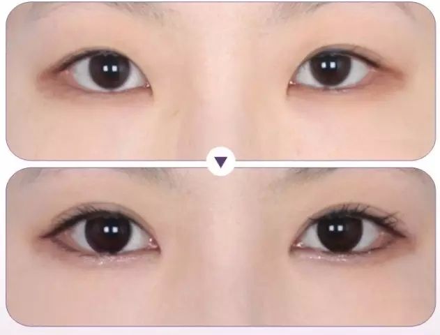 深圳*整形價(jià)格是多少