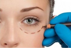 上海超聲波做眼袋多少錢