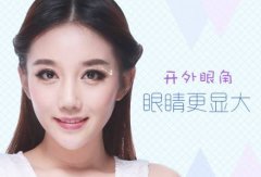 廣東開外眼角價(jià)格是多少