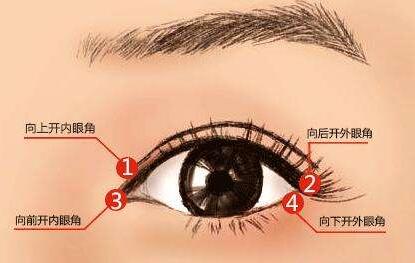 上海韓式開(kāi)內(nèi)眼角多少錢