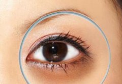 北京玻尿酸去黑眼圈價格