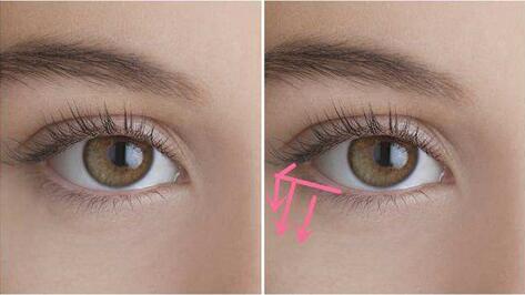 上海下眼下至術(shù)價格