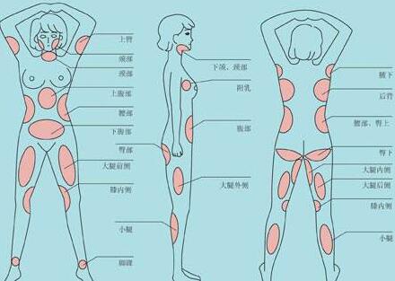 南京吸脂減肥價(jià)格是多少？