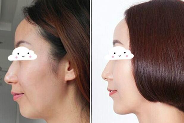 瑞蘭2號多少錢一支