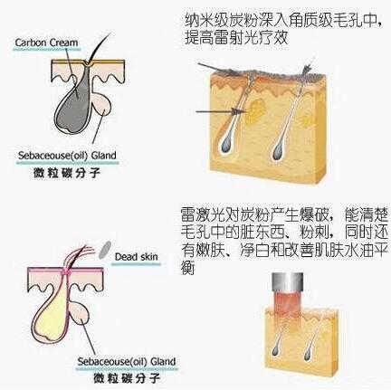 做黑臉娃娃多少錢 做黑臉娃娃多少錢一次