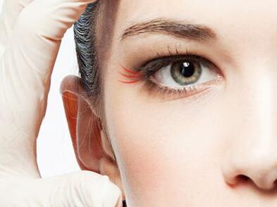 雙眼皮埋線后注意什么 術(shù)后注意事項(xiàng)有哪些