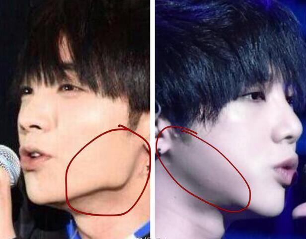 華晨宇整容前后照片 華晨宇做了下頜角整形？