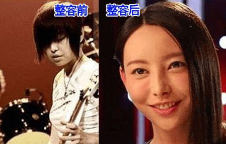 于文文整容了嗎？于文文整容前后圖