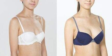 重慶假體豐胸,介紹,隆胸的優(yōu)勢