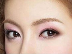 開(kāi)眼角會(huì)留疤么