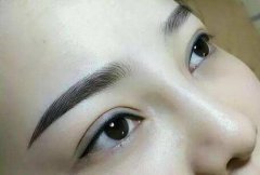 種植眉毛去哪里做好呢