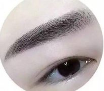 種植眉毛調(diào)節(jié)眉毛缺損手術(shù)是什么？