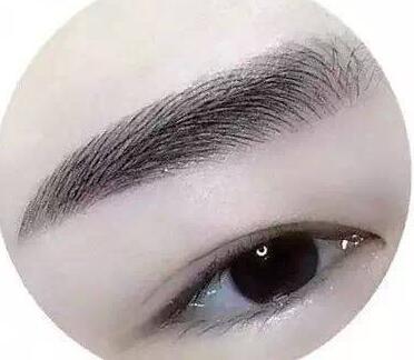 種植眉毛調(diào)節(jié)眉毛缺損手術(shù)是什么？