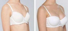 假體豐胸手術(shù)費(fèi)用是多少？假體豐胸多少錢？