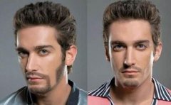 種植胡須充血怎么回事？種植胡須為什么會充血？