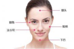 中面部提升術會維持幾年？中面部提升術會維持多久？