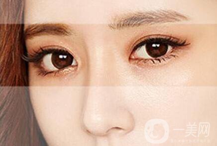 割雙眼皮的價格貴不貴？多少錢？