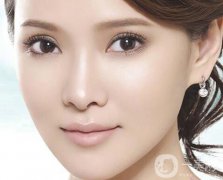 割雙眼皮要恢復(fù)多久 注意事項(xiàng)有哪些