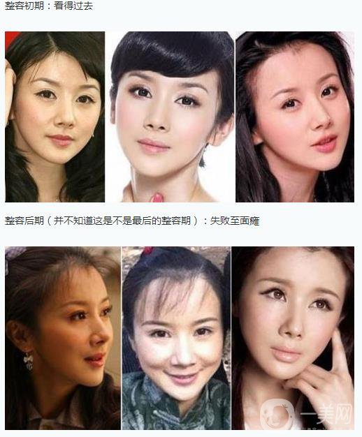 孫菲菲整容了嗎 孫菲菲整容前后圖片