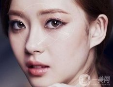 開眼角手術(shù)過程 開眼角前后照片圖