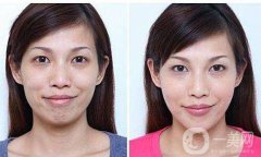 熱瑪吉果好嗎？熱瑪吉除皺果怎么樣？