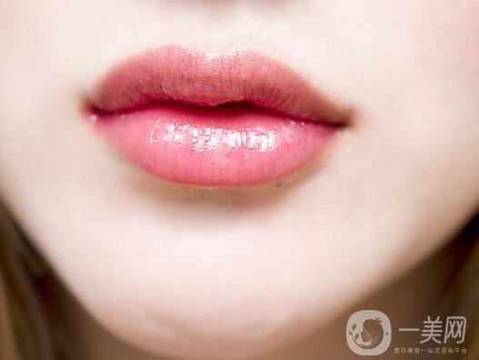 豐唇多少錢？豐唇價格明細盤點~