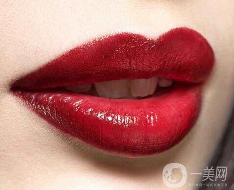 豐唇多少錢？豐唇價格明細盤點~