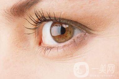 怎么才能去掉魚尾紋 去掉魚尾紋有哪些方法