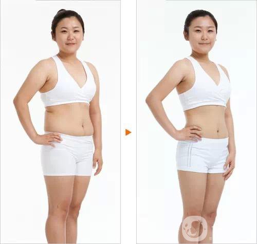 360吸脂減肥多久恢復正常?要注意些什么？