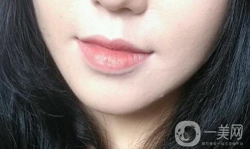 墊下巴后多久可以按摩 術(shù)后如何護理