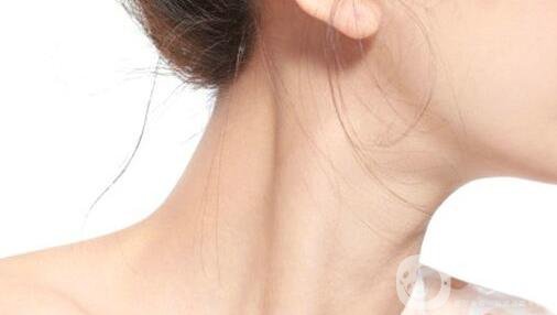 有頸紋怎么辦？去頸紋什么方法好？