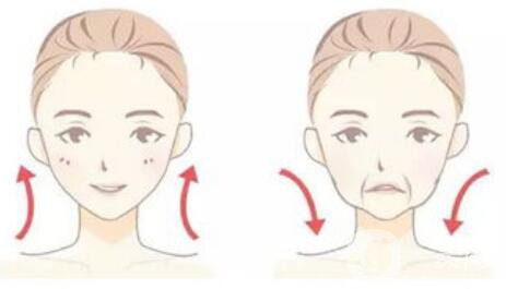 怎么除去法令紋？什么方法可以去法令紋？