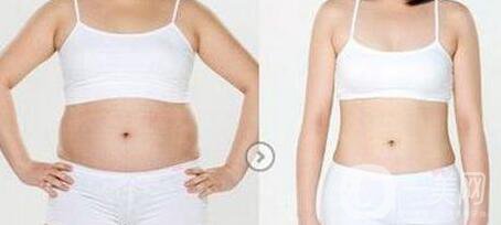 南京吸脂減肥的價(jià)格是多少？吸脂減肥大概多少錢？