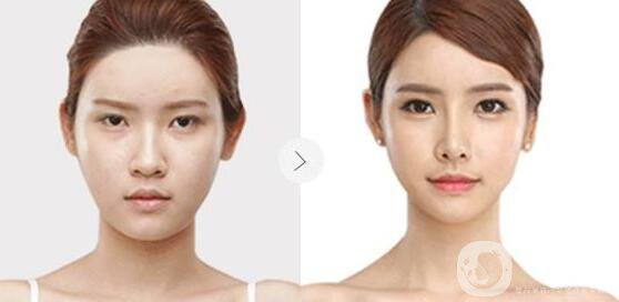 瑞蘭2號(hào),多少錢(qián)