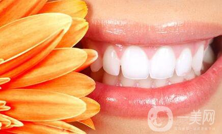 美容冠多少錢一顆 美容冠價(jià)格介紹