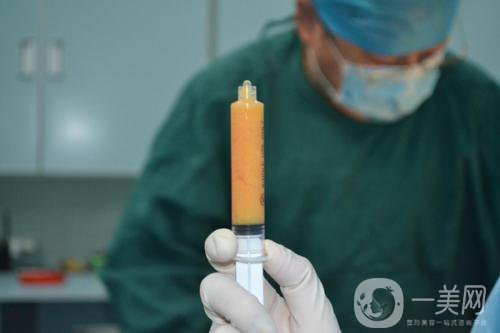 抽脂形體改良怎么做才能恢復(fù)好？