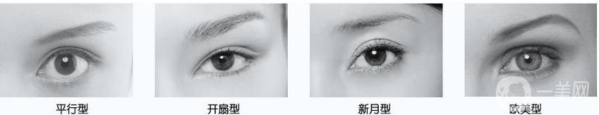 什么是高分子雙眼皮 價(jià)格多少錢？