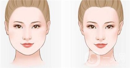 *一針要多少錢 正規(guī)醫(yī)院*價(jià)格貴嗎