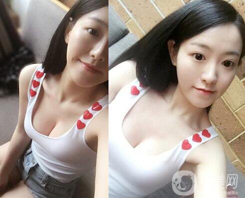 什么叫水滴隆胸 水滴隆胸怎么樣