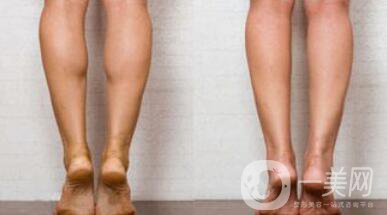 詳細(xì)介紹**到底有沒有副作用