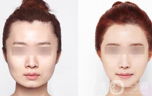 *價(jià)格多少？詳解*具體費(fèi)用