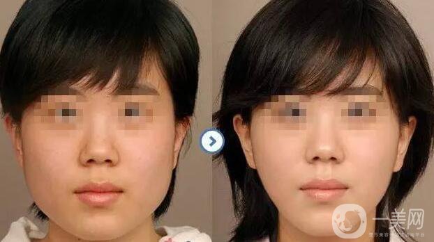 *價(jià)格多少？詳解*具體費(fèi)用