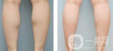 **果嗎、*有副作用嗎