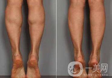 **果嗎、*有副作用嗎