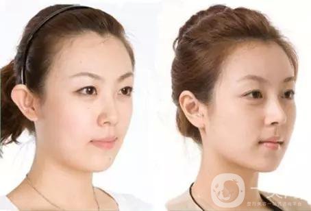 做完*手術(shù)7天能恢復(fù)嗎？