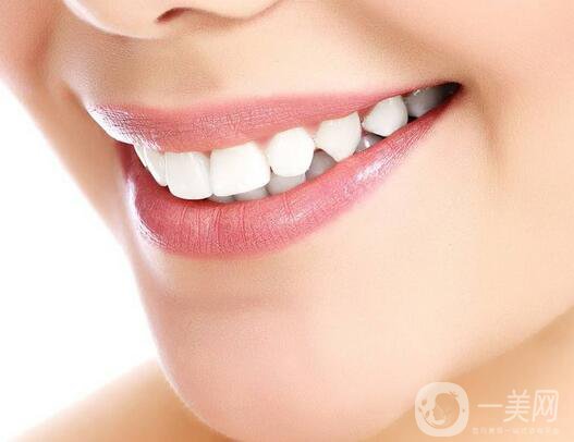 烤瓷牙多少錢 烤瓷牙價格是多少