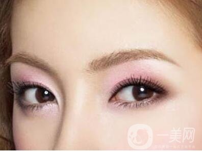 割雙眼皮,開眼角,價格