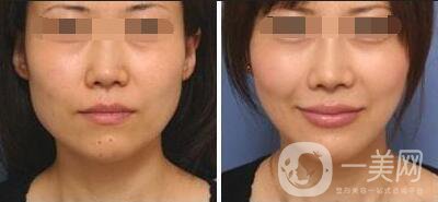 **多少錢 **價格詳解